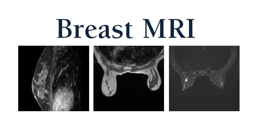 Breast MRI